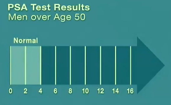 Psa Blood Test Chart