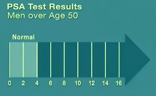 Psa Levels Range Chart